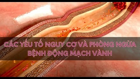 Yếu tố nguy cơ và Phòng ngừa động mạch vành | Alo bác sĩ Chuyên trang Tạp chí Sức khoẻ Cộng đồng