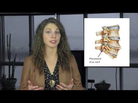 Vidéo: Arthrose Vertébrale