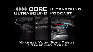 Maximize Your Soft Tissue Ultrasound Skills screenshot 2