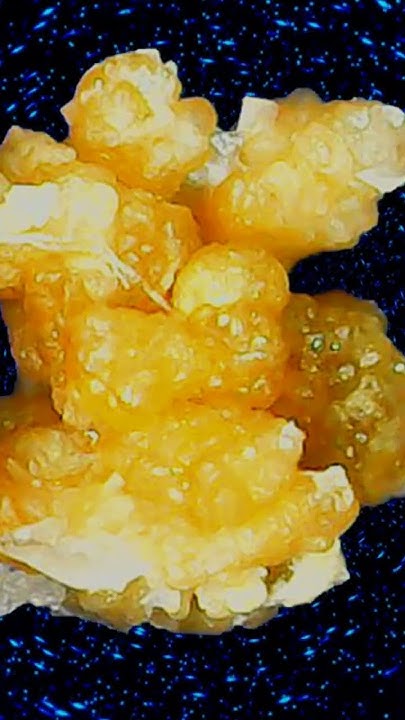 new-2-mm-kidney-stone-seen-with-microscope-kidneystone-youtube