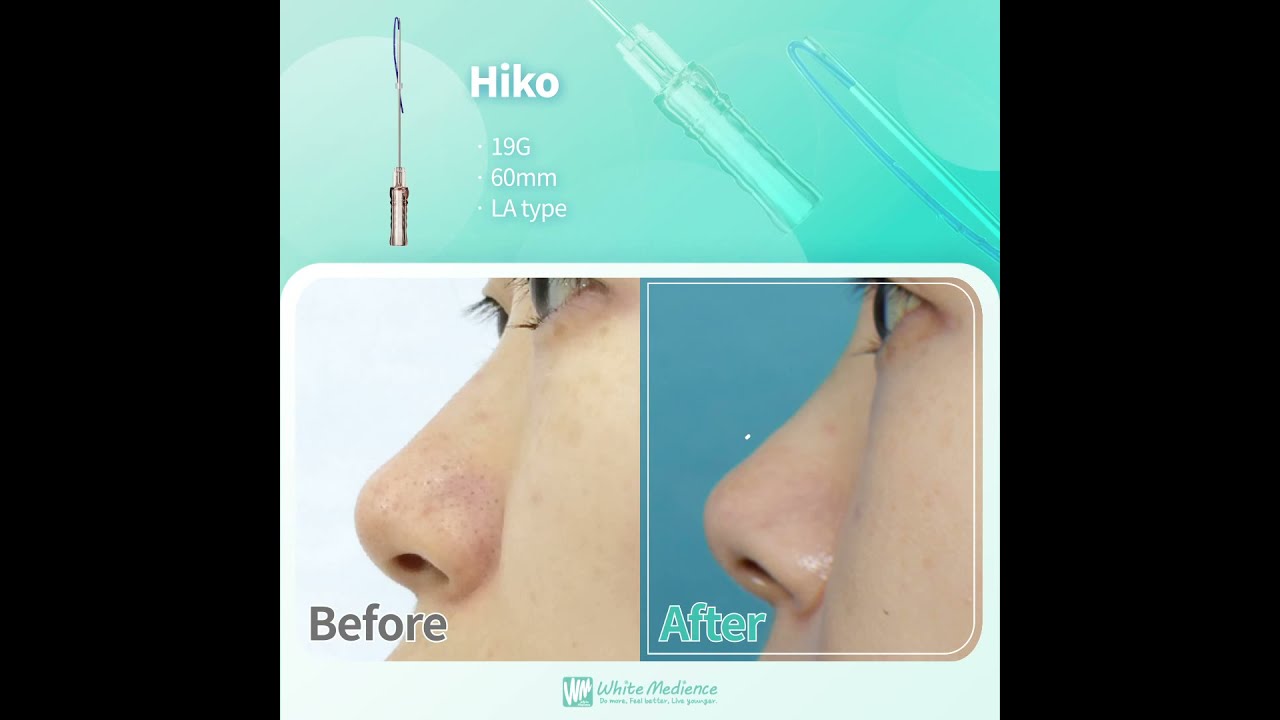 B&A WM Hiko - WhiteMedience 