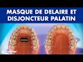 Masque de Delaire et disjoncteur palatin - Tipes d’orthodontie ©
