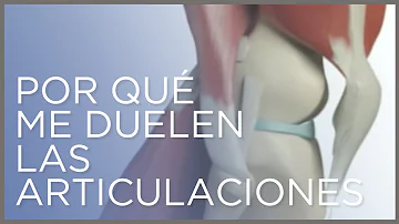 ¿Cómo evitar que le duelan las articulaciones?