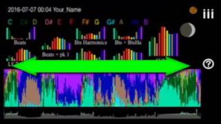 Celebrity itHRVEe  How to access overnight long term analysis records and to access display graphs Profile
