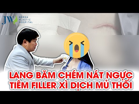Video NÁO LOẠN thẩm mỹ chui bác sĩ KHOA SẢN tự ý NÂNG NGỰC... - youtube