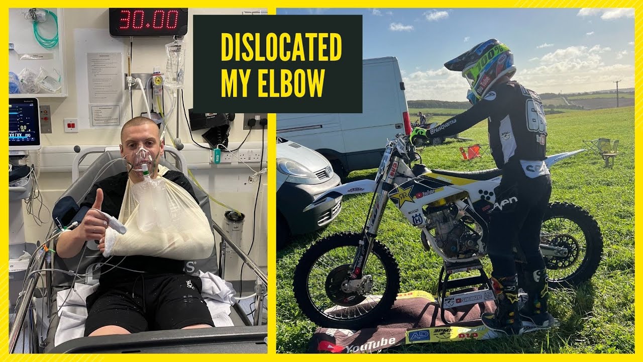 I DISLOCATED MY ELBOW RIDING At Hampton Mx Track