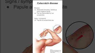 Catscratch disease