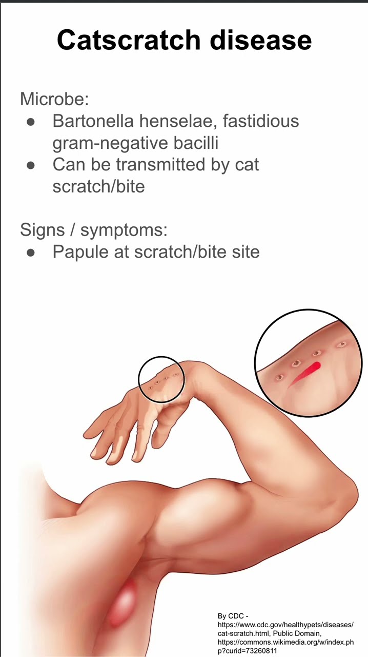 How to Tell if My Wound Is Infected - Elitecare Emergency Hospital