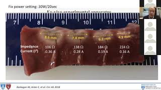 Sauer 4 24 20 Biophysics of RF Ablation