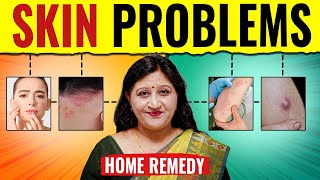 Skin Problem Treatment - Eczema, Psoriasis, Fungal Infection By Acupressure