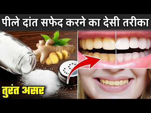 पीले दांत सफेद करने का देसी तरीका | Teeth Whitening Hack You Can't-Miss