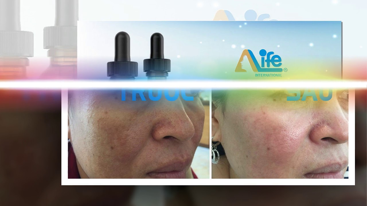 Hệ Thống Điều Trị Da Md Dermatics