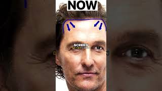 Did Matthew McConaughey Really Get a Hair Transplant? The Truth 😱