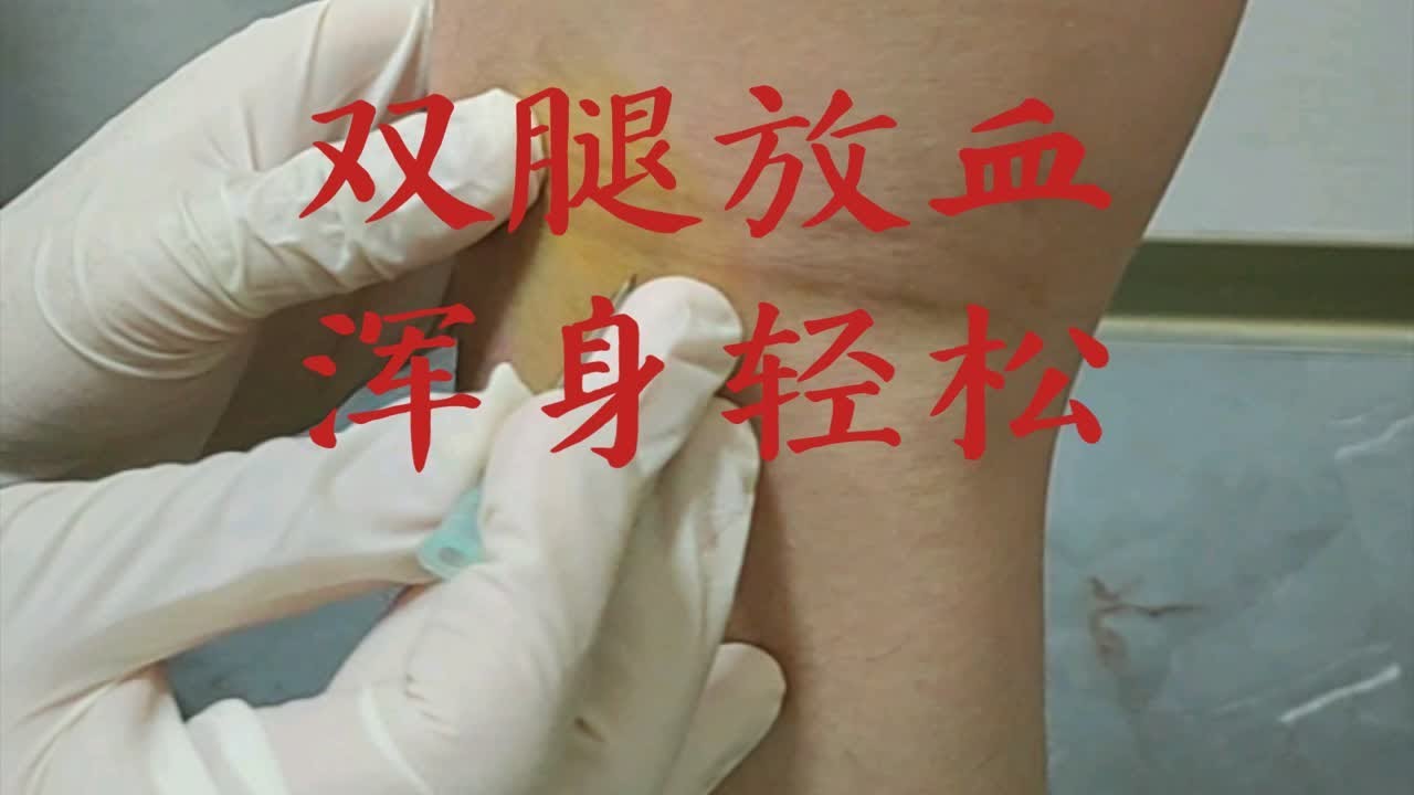 委中委阳刺血,效果明显。 - YouTube