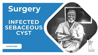 Today in Clinic: Infected Sebaceous Cyst