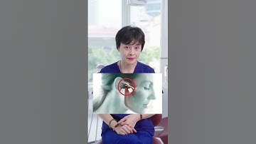 Những biến chứng của niềng răng, chuẩn bị niềng nên biết | Nha Khoa ViDental #nhakhoa #niengrang