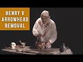 Henry v arrowhead removal  medieval surgery