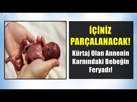 Bebeğin Kurt-aj Olurken Annesi İle Konuşması İÇİNİZİ PARÇALAYAN İBRETLİK HİKAYE - Can Demiryel