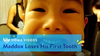maddox loses his first tooth home videos hiho kids