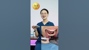 Xẻ kẽ răng có tác dụng gì?  #shorts #niengrang #xuhuong #nhakhoathuyanh