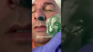 here’s how to remove the wax from nostril without a stick. #esthetician #waxing#waxingvideos here’s how to remove the wax from nostril without a stick. #esthetician #waxing#waxingvideos