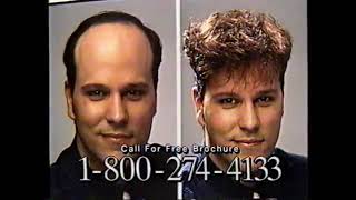 Hair Club For Men Tv Ad - 19881989