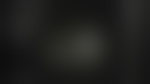 Submucosal tumor of the stomach.NET? Abrikosov tumor?