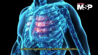 ¿Cómo actúa la fibrosis quística? - #ExclusivoMSP