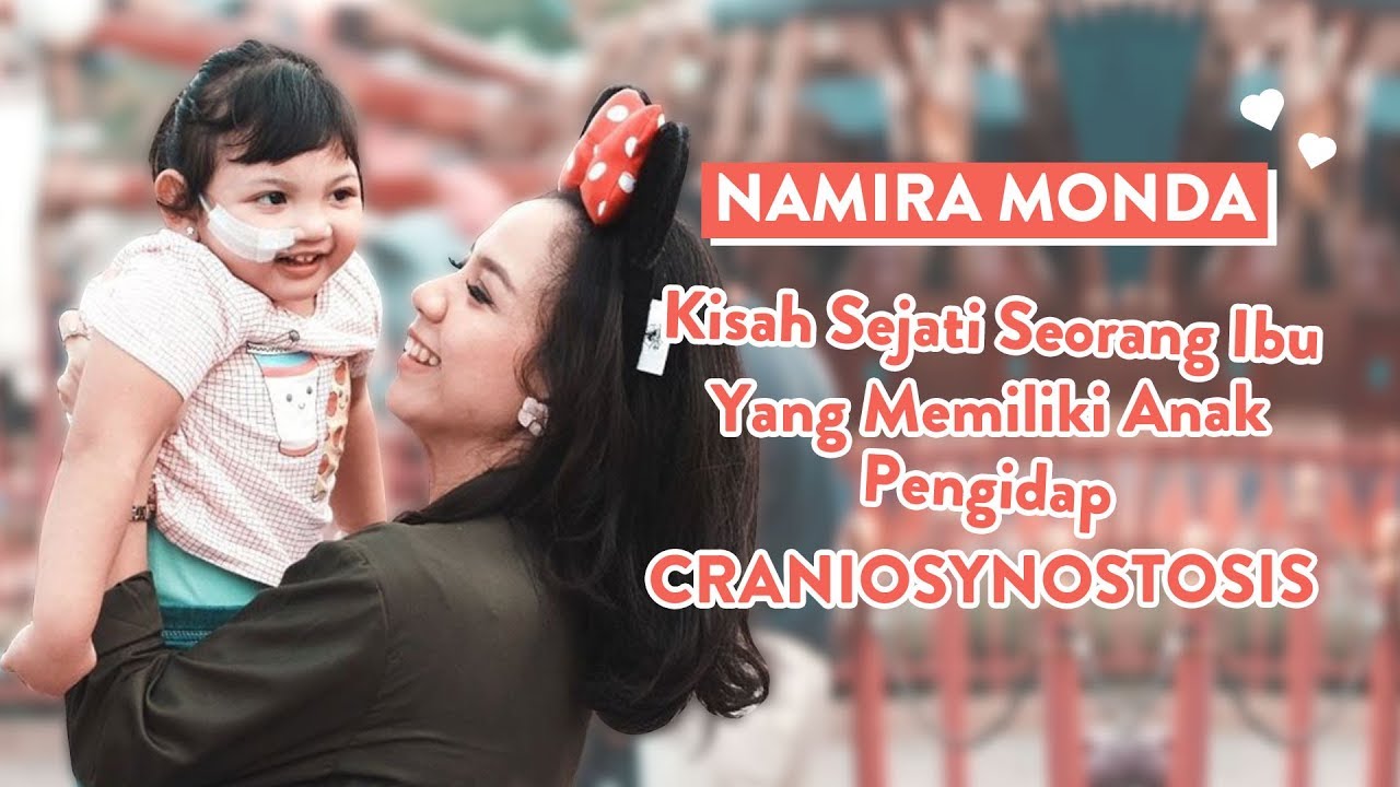 Kisah Nyata Perjuangan Namira Monda, Memiliki Anak Dengan Craniosynostosis | Mom Story