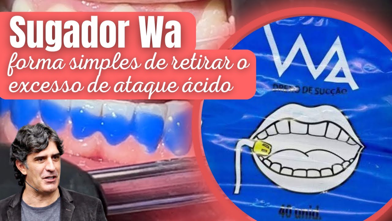 Sugador Wa: forma simples de retirar o excesso de ataque ácido!