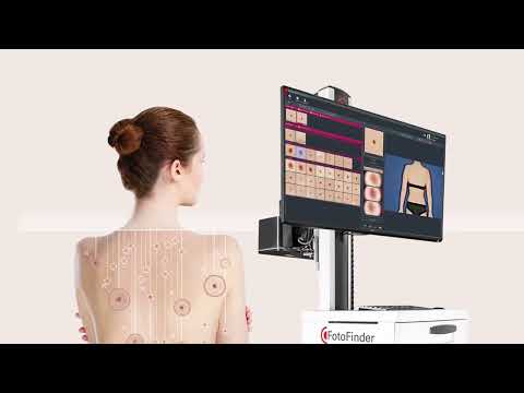 FotoFinder bodystudio ATBM - цифровые технологии для ранней диагностики рака кожи