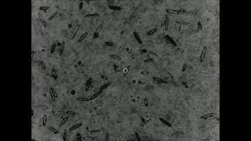 X-ray diffraction data collection with a novel in-situ serial crystallography platform (Demo Video)