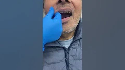 No More loose Dentures: Stable, Well-Fitting Dentures | Bespoke Dentures | Vallance Dental Centre