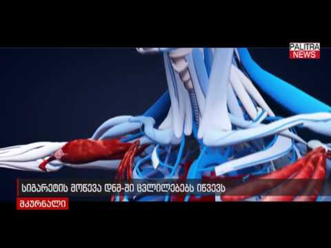 სიგარეტის მოწევა დნმ-ში ცვლილებებს იწვევს