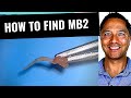Root Canal Access Maxillary Molar (MB2 Tips)