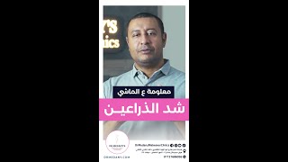 شد الذراعين في عيادات ميك اوفر كلينيك دكتور محمد مدني - عملية نحت الذراعين - ترهلات الذراعين