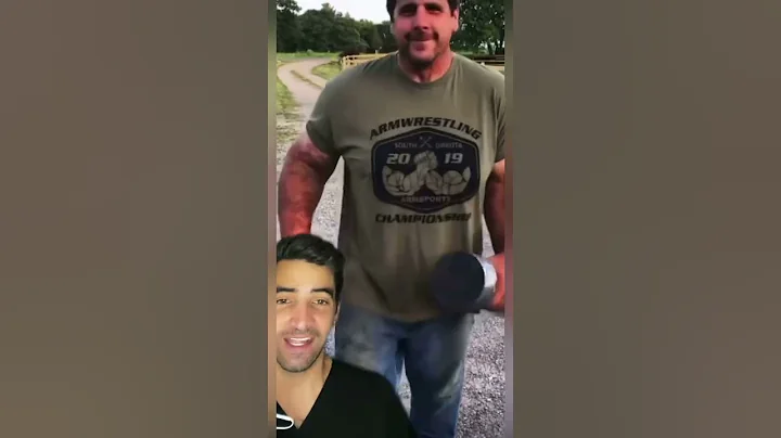 Overproduction of Growth Hormone