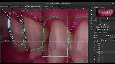 DSD Digital Smile Design
