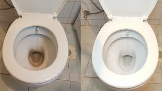 Sararmış Klozet Nasıl Temizlenir | Tuvalet Kireci Temizleme yöntemi