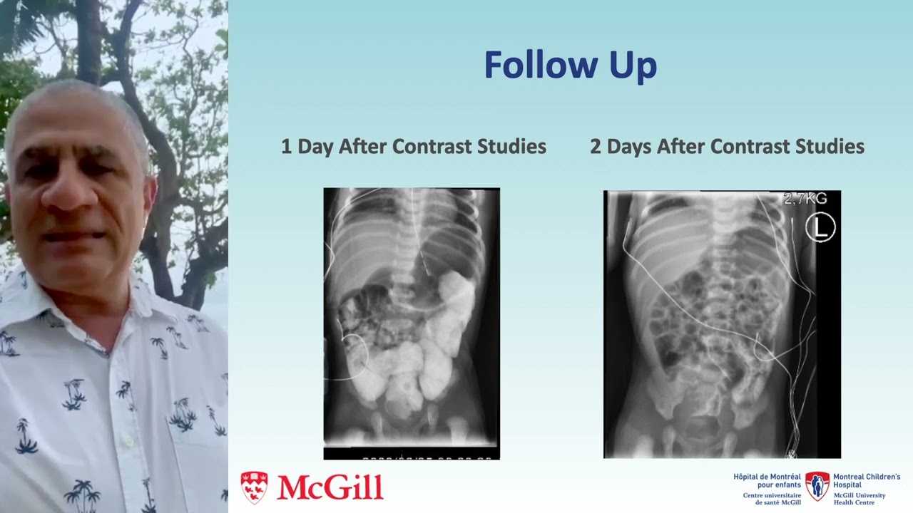 Sherif Emil MD,CM on X: We have held this meeting weekly at  @HopitalChildren for over 40 years -- one of the most popular surgical  teaching conferences and has inspired #casebasedpedsurgtext. Now we