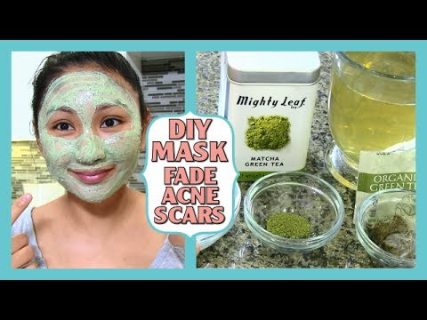 DIY ACNE SCAR FADING MASK!  How to fade acne scars!