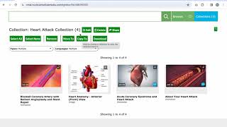 Creating and Accessing Collections on the New Doe Report