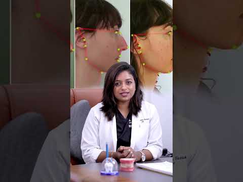Confused if mewing work? Then watch this video part 2 #mewing #teeth #dentalclinic
