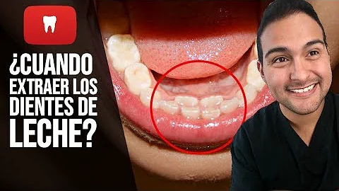 ¿Se pueden caer los dientes tarde?