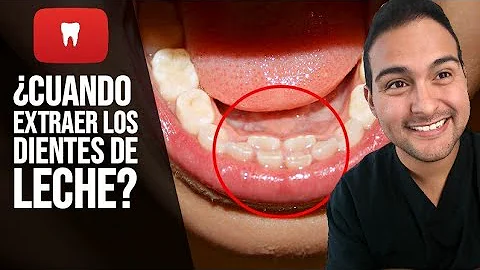 ¿Los dientes de leche son más pequeños?