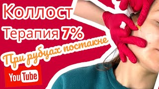 Коллост терапия при рубцах постакне