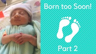 Born Too Soon Part 2!\/ Birth story.