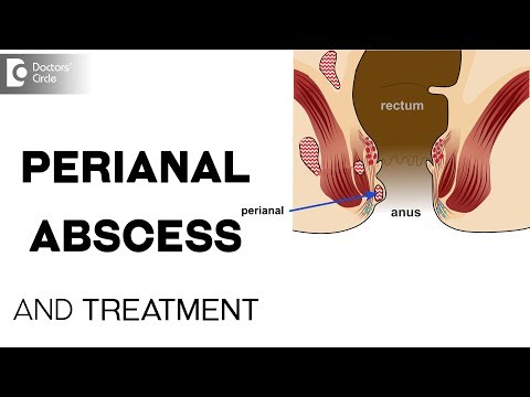 וִידֵאוֹ: האם אבצס פרי רקטלי הוא חירום?