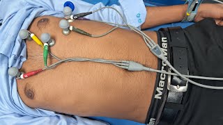 ECG- electrocardiography #electrocardiography @hitkaribara1419