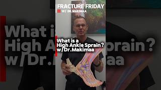 How to tell the difference between a high vs. normal ankle sprain 